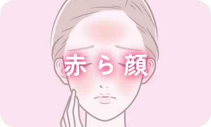 赤ら顔